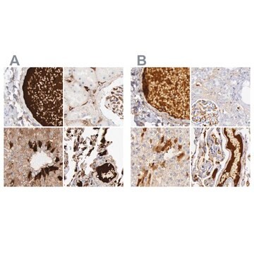 Anti-C4BPA antibody produced in rabbit Ab1, Prestige Antibodies&#174; Powered by Atlas Antibodies, affinity isolated antibody, buffered aqueous glycerol solution