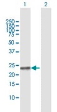 Anti-NME5 antibody produced in rabbit purified immunoglobulin, buffered aqueous solution