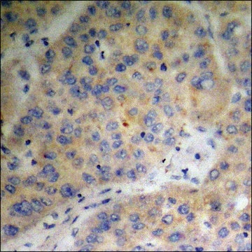 Anti-phospho-Survivin (pThr34) antibody produced in rabbit affinity isolated antibody