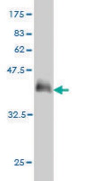 Monoclonal Anti-PHF21A antibody produced in mouse clone 5A6, purified immunoglobulin, buffered aqueous solution