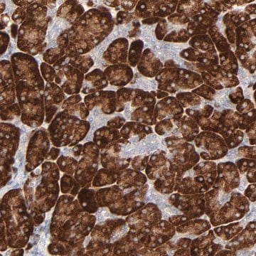 Anti-FANCB antibody produced in rabbit Prestige Antibodies&#174; Powered by Atlas Antibodies, affinity isolated antibody, buffered aqueous glycerol solution