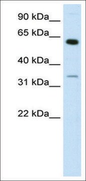 Anti-ZNF609 antibody produced in rabbit IgG fraction of antiserum