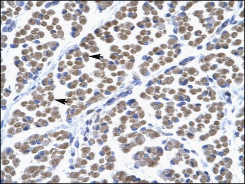 Anti-TBX5 (AB1) antibody produced in rabbit affinity isolated antibody