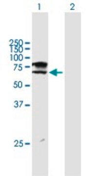 ANTI-ST6GALNAC1 antibody produced in mouse purified immunoglobulin, buffered aqueous solution