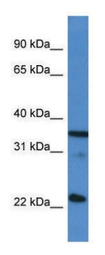 Anti-SFRS2 (C-terminal) antibody produced in rabbit affinity isolated antibody