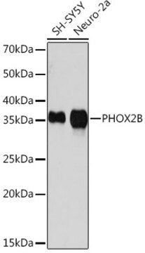 Anti-PHOX2B Antibody, clone 4W5J8, Rabbit Monoclonal