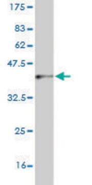 Monoclonal Anti-CNDP2 antibody produced in mouse clone 1B1, purified immunoglobulin, buffered aqueous solution