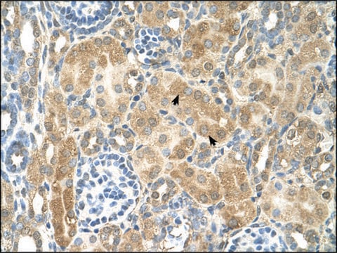 Anti-NR2F2 (AB2) antibody produced in rabbit IgG fraction of antiserum