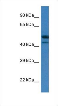 Anti-SBK1 antibody produced in rabbit affinity isolated antibody