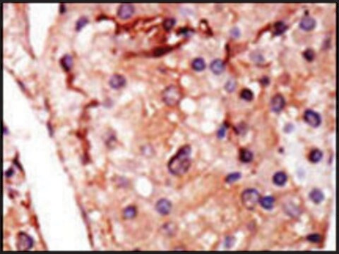 Anti-PFKFB2 (N-term) antibody produced in rabbit IgG fraction of antiserum, buffered aqueous solution