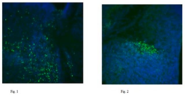 Anti-Prospero homeobox protein 1/PROX1 Antibody from rabbit, purified by affinity chromatography