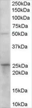 Anti-Prostaglandin Dehydrogenase 1 antibody produced in goat affinity isolated antibody, buffered aqueous solution