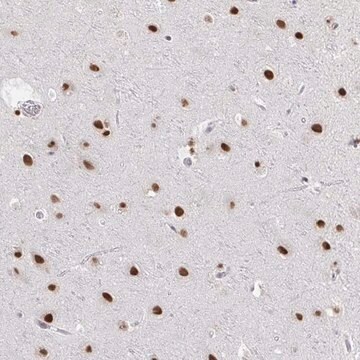 Anti-HNRNPDL antibody produced in rabbit Prestige Antibodies&#174; Powered by Atlas Antibodies, affinity isolated antibody, buffered aqueous glycerol solution