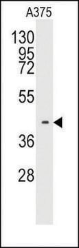 Anti-TBRG1 (center) antibody produced in rabbit saturated ammonium sulfate (SAS) precipitated, buffered aqueous solution