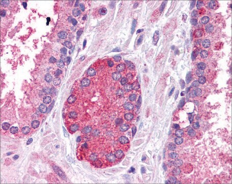 Anti-STAT3 antibody produced in rabbit affinity isolated antibody