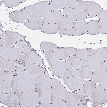 Anti-USP35 antibody produced in rabbit Prestige Antibodies&#174; Powered by Atlas Antibodies, affinity isolated antibody, buffered aqueous glycerol solution