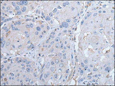 Anti-LTBP4 affinity isolated antibody