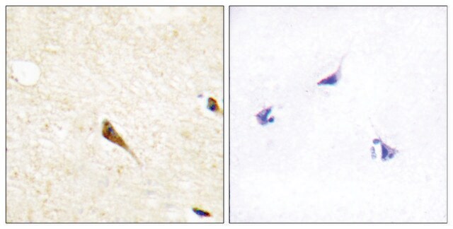 Anti-MOK antibody produced in rabbit affinity isolated antibody