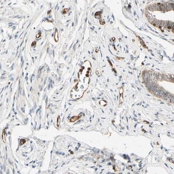 Anti-TAPBP antibody produced in rabbit Prestige Antibodies&#174; Powered by Atlas Antibodies, affinity isolated antibody, buffered aqueous glycerol solution