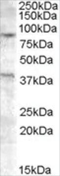 Anti-EXO1 antibody produced in goat affinity isolated antibody, buffered aqueous solution