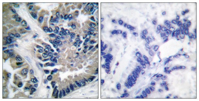 Anti-STAT2 antibody produced in rabbit affinity isolated antibody