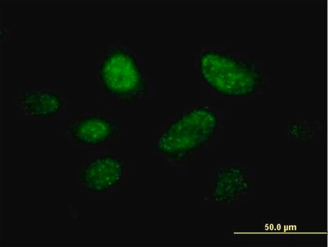 Anti-C14ORF106 antibody produced in mouse purified immunoglobulin, buffered aqueous solution