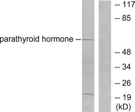 Anti-Parathyroid Hormone antibody produced in rabbit affinity isolated antibody