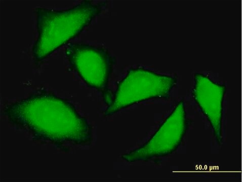 Anti-KIAA1404 antibody produced in mouse purified immunoglobulin, buffered aqueous solution