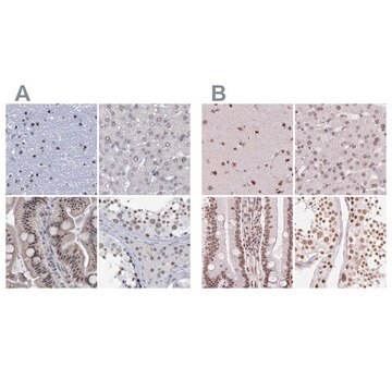 Anti-SREK1 antibody produced in rabbit Prestige Antibodies&#174; Powered by Atlas Antibodies, affinity isolated antibody, buffered aqueous glycerol solution