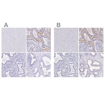 Anti-SLC5A1 antibody produced in rabbit Prestige Antibodies&#174; Powered by Atlas Antibodies, affinity isolated antibody, buffered aqueous glycerol solution