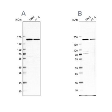 Anti-EPRS antibody produced in rabbit Prestige Antibodies&#174; Powered by Atlas Antibodies, affinity isolated antibody, buffered aqueous glycerol solution