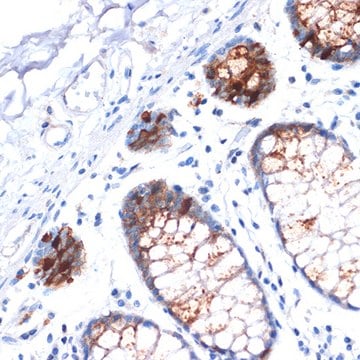 Anti-IGFBP2 Antibody, clone 4B2G6, Rabbit Monoclonal