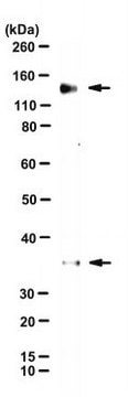 Anti-MST1R/CD136 Antibody