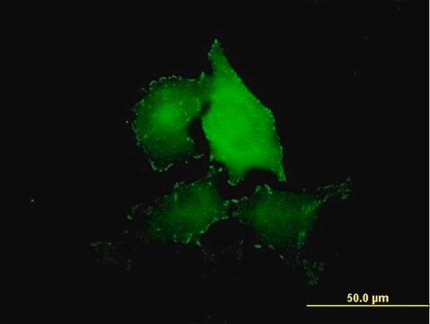 Anti-TNS4 antibody produced in mouse purified immunoglobulin, buffered aqueous solution