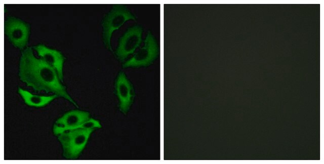 Anti-ADCK4 antibody produced in rabbit affinity isolated antibody