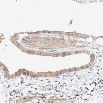 Anti-EIF2AK4 antibody produced in rabbit Prestige Antibodies&#174; Powered by Atlas Antibodies, affinity isolated antibody, buffered aqueous glycerol solution