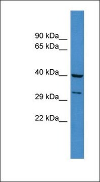 Anti-DUSP11 antibody produced in rabbit affinity isolated antibody