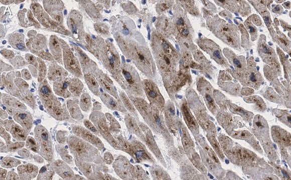 Anti-GLUT-4 Antibody, clone 1M13 ZooMAb&#174; Rabbit Monoclonal recombinant, expressed in HEK 293 cells