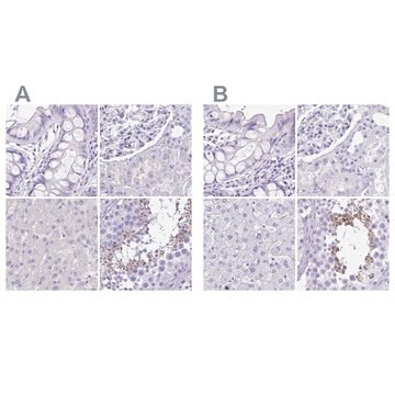 Anti-SPERT antibody produced in rabbit Prestige Antibodies&#174; Powered by Atlas Antibodies, affinity isolated antibody, buffered aqueous glycerol solution