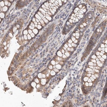 Anti-UNK antibody produced in rabbit Prestige Antibodies&#174; Powered by Atlas Antibodies, affinity isolated antibody, buffered aqueous glycerol solution, ab1