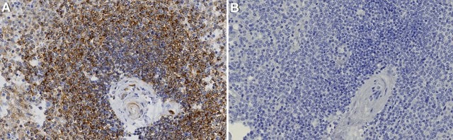 Anti-PAFAH/PLA2G7 Antibody, clone 1E9 ZooMAb&#174; Rabbit Monoclonal recombinant, expressed in HEK 293 cells