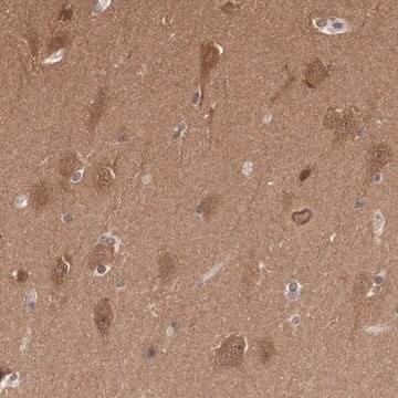 Anti-PDXP antibody produced in rabbit Prestige Antibodies&#174; Powered by Atlas Antibodies, affinity isolated antibody, buffered aqueous glycerol solution