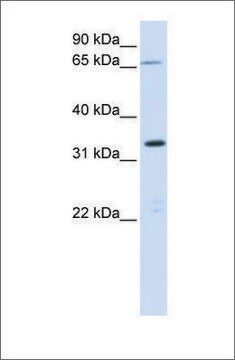 Anti-C19ORF47 antibody produced in rabbit affinity isolated antibody