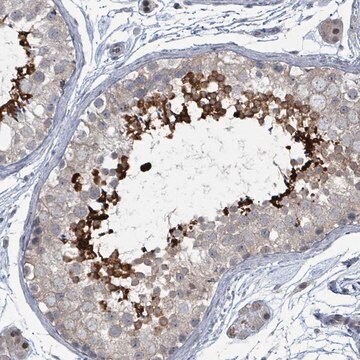 Anti-BIVM antibody produced in rabbit Prestige Antibodies&#174; Powered by Atlas Antibodies, affinity isolated antibody, buffered aqueous glycerol solution