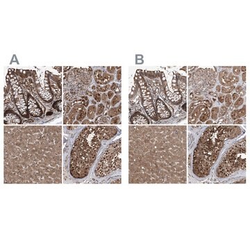 Anti-PSMB1 antibody produced in rabbit affinity isolated antibody, buffered aqueous glycerol solution, ab2