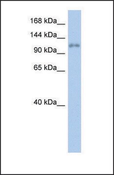 Anti-ZNF217, (N-terminal) antibody produced in rabbit affinity isolated antibody