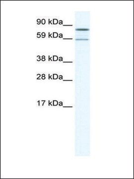 Anti-PARN antibody produced in rabbit IgG fraction of antiserum