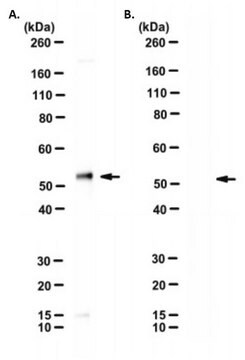 Anti-SARS-CoV-2 nucleocapsid Antibody, clone 7C5-B5