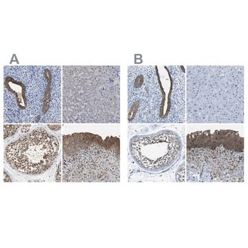 Anti-TES antibody produced in rabbit Prestige Antibodies&#174; Powered by Atlas Antibodies, affinity isolated antibody, buffered aqueous glycerol solution