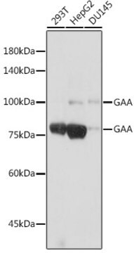 Anti-GAA Antibody, clone 5L2L10, Rabbit Monoclonal